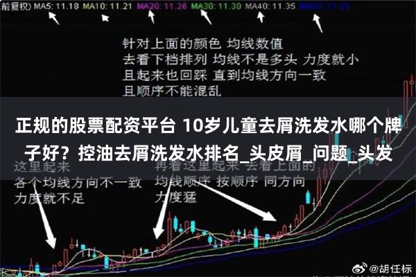 正规的股票配资平台 10岁儿童去屑洗发水哪个牌子好？控油去屑